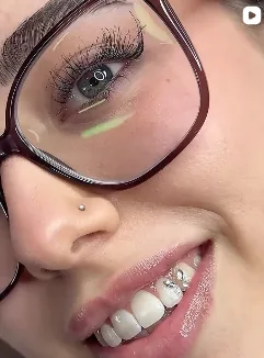 Clienta sonriendo con brillantes dentales